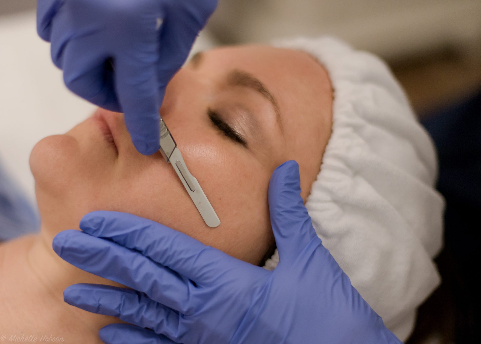Dermaplaning Exposed- Monday Nov 10th 2025