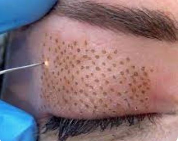 Trending in Esthetics Signature Class