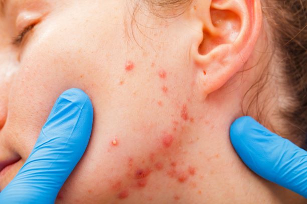 SOLD OUT Mastering Skin Conditions & Identifying Lesions - Sept 8th 2025 9:00am- 4:00pm