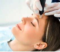 Microneedling Exposed Signature Class