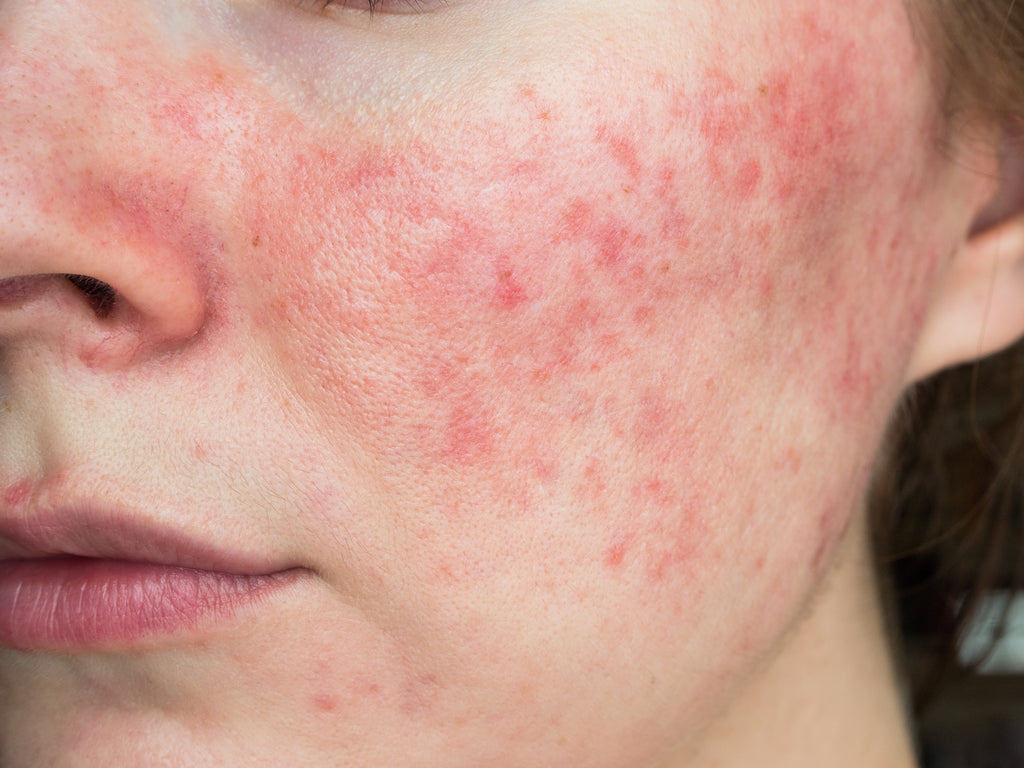 Hormones & The Skin: From Cortisol to Collagen- 7/20/26